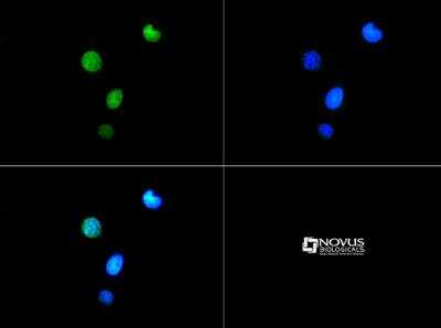 Immunocytochemistry/ Immunofluorescence: Histone H3 [p Thr6, Trimethyl Lys9] Antibody - BSA Free [NB21-1054]